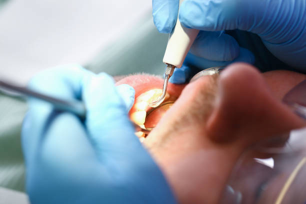 Best Emergency Cosmetic Dentistry (e.g., broken veneers) in Inola, OK